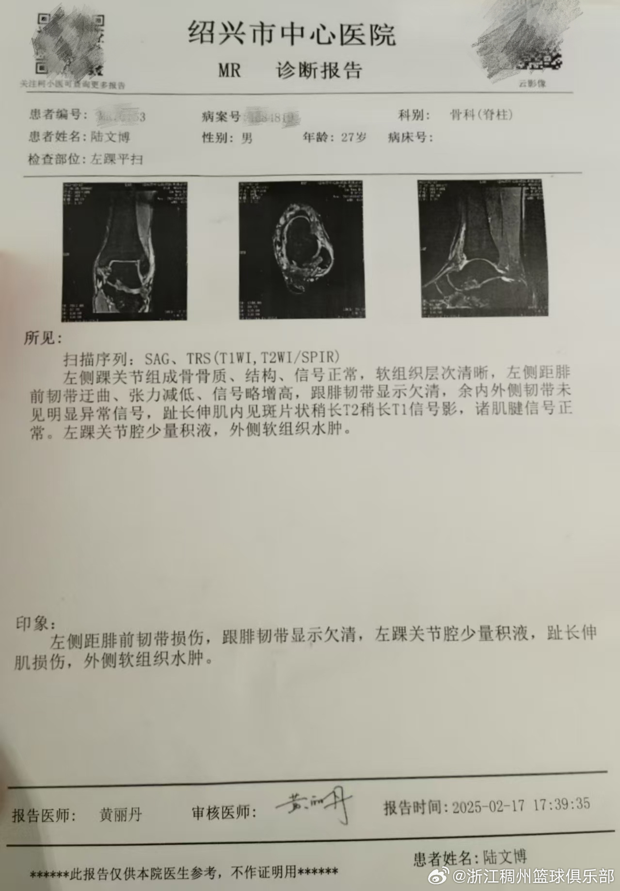的防线疲于